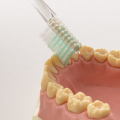 【歯石の原因】歯石のつきやすい方へ