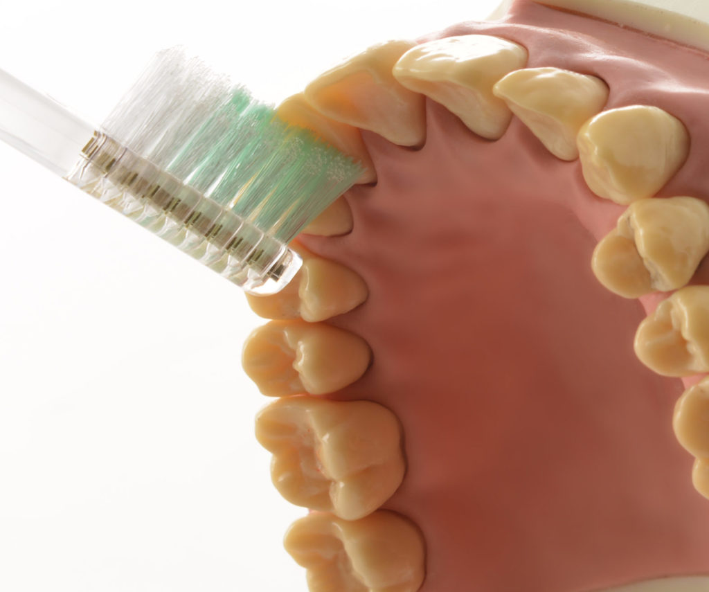 上前歯裏ブラッシング