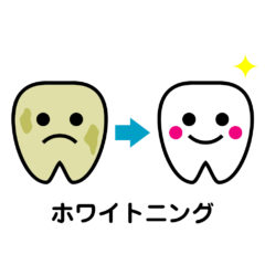 【歯の着色】ステインを落とす