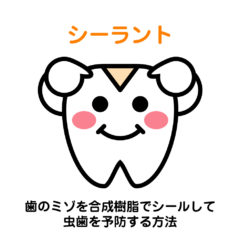 【虫歯予防】シーラントとは？