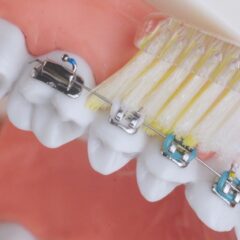 【歯ブラシの当て方動かし方】家族で選ぶ歯ブラシ、迷ったらコレ!
